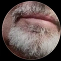 Misternut