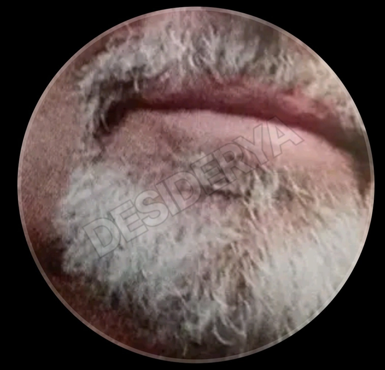 Annuncio (8590341) - Misternut 1