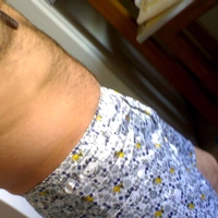 Alberto